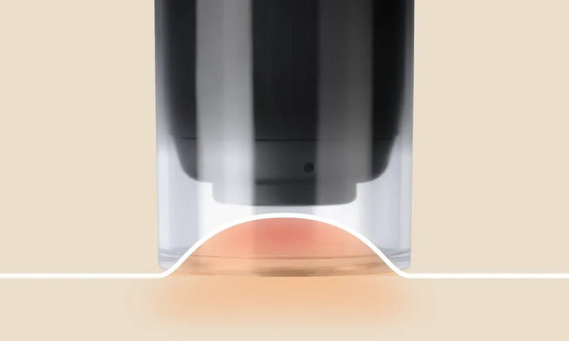 Suction Decompression